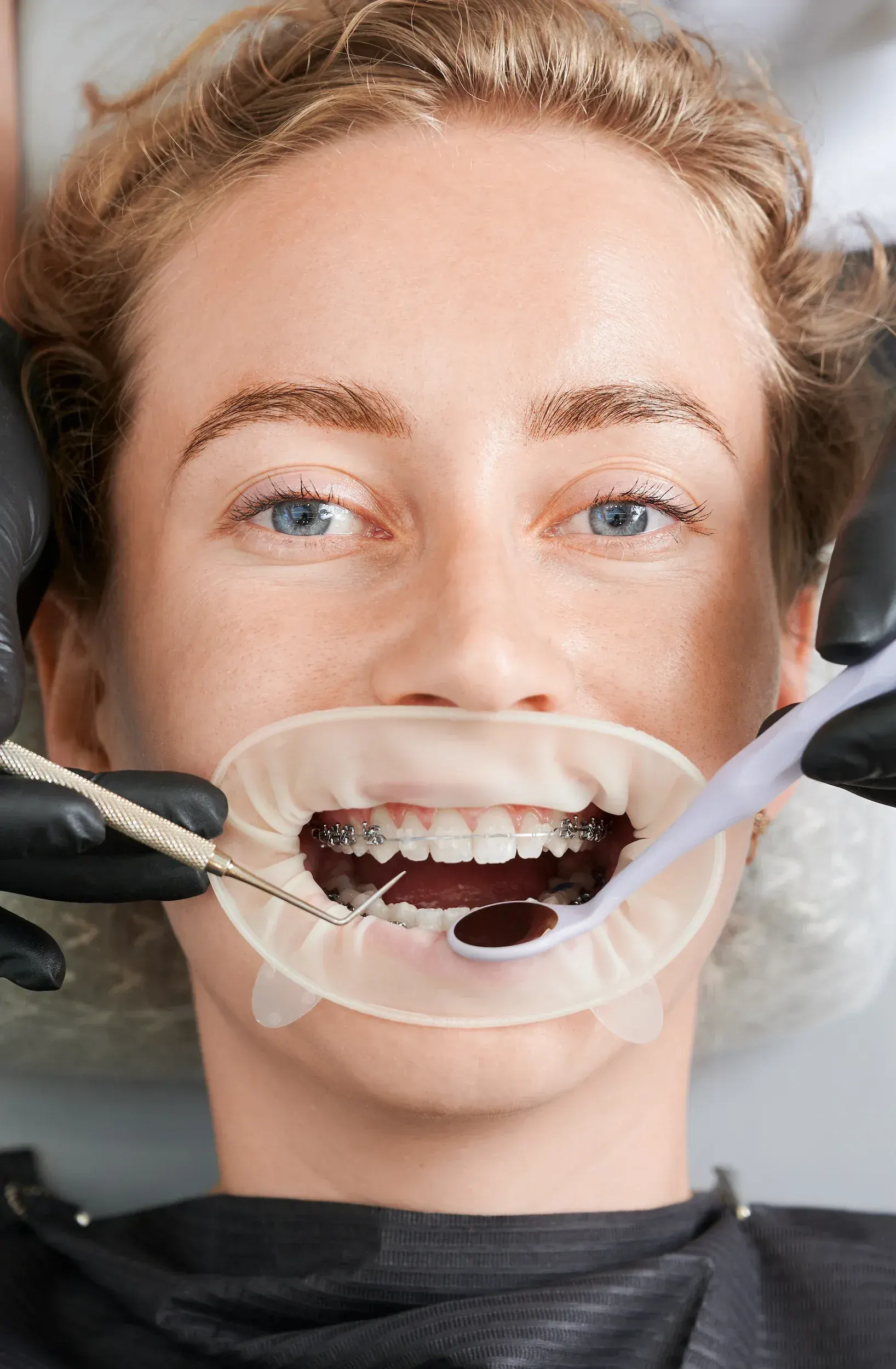 Patient smiling after enameloplasty consultation at Enclave Dental Lake Mary FL