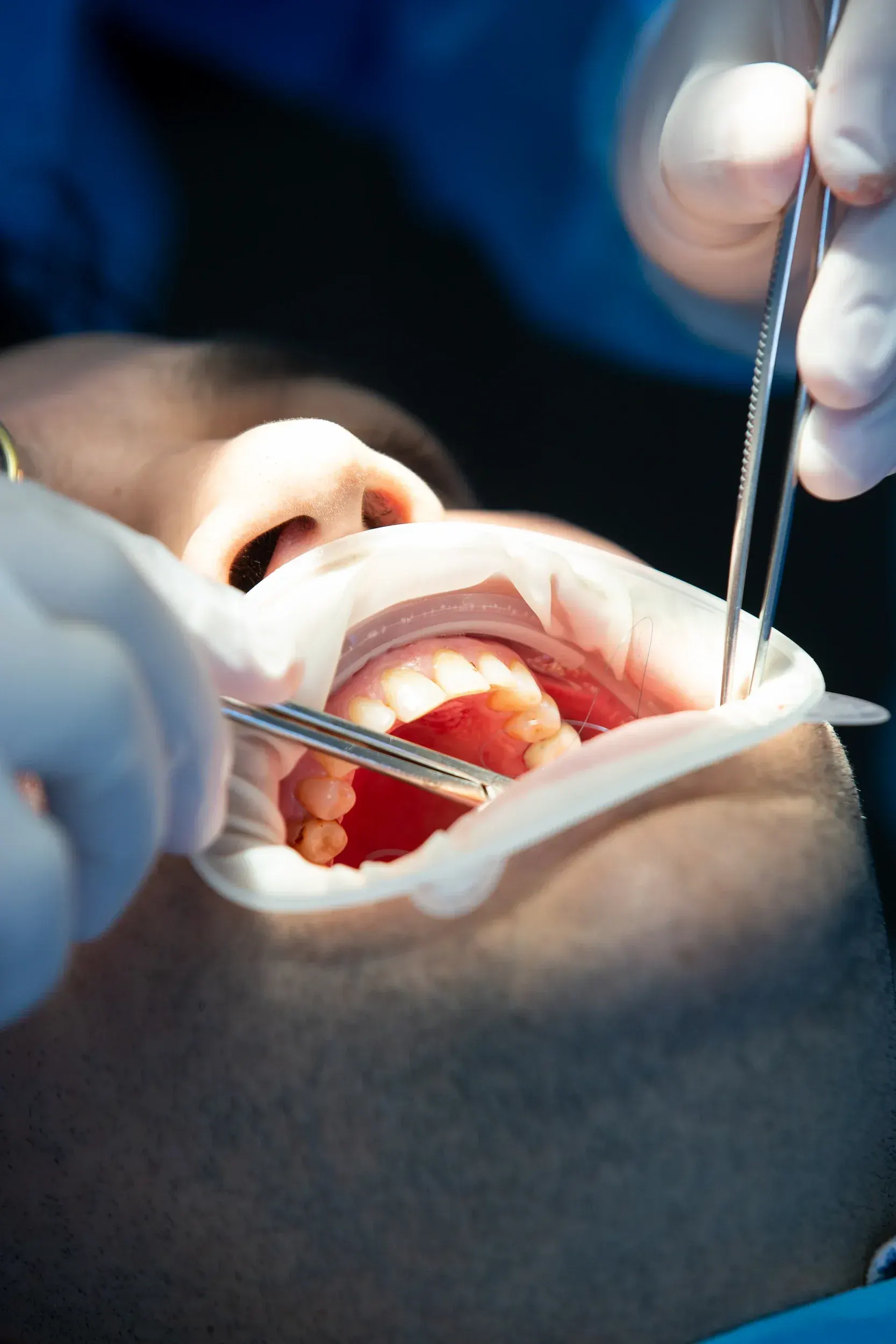 Confident dental implant candidate smiling after consultation at Enclave Dental Lake Mary